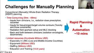 AI ADVANCEMENTS IN HEALTHCARE AUTOMATED WHOLE‐BRAIN RADIATION THERAPY TREATMENT PLANNING [upl. by Akiehs]