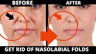 🛑 EFFECTIVE FACE YOGA FOR NASOLABIAL FOLDS  SMILE LINES  LAUGH LINES SAGGY SKIN JOWLS FOREHEAD [upl. by Allebram]