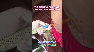 PLEURAL PUNCTURE TECHNIC FOR EMPYEMA  syarhan ruralhealthcare [upl. by Austin]