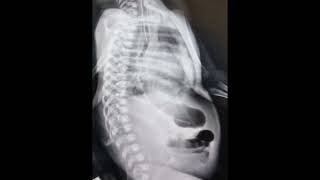 Newborn Xray l Abdominal Xray l Pause review comment nicu [upl. by Sinnaoi326]