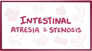 Intestinal atresia amp stenosis  an Osmosis Preview [upl. by Orlanta]