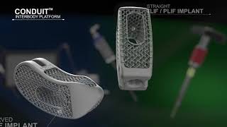 DePuy Synthes Spine UNLEASH MIS TLIF Procedural Solution Animation [upl. by Baxy]