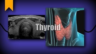 Thyroid Ultrasound [upl. by Budwig]