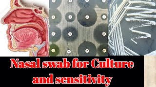 Nasal Swab for culture and sensitivity CS test [upl. by Acisej156]