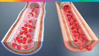 Cómo destapar las arterias de forma natural  Mensajes Positivos [upl. by Delcine795]