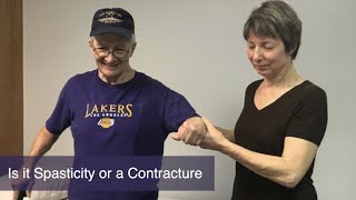 Is It Spasticity Or A Contracture [upl. by Aretta]