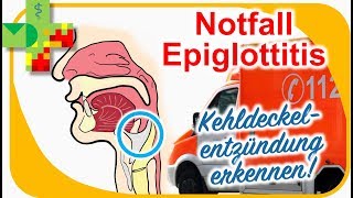 Epiglottitis  Kehldeckelentzündung erkennen und richtig reagieren [upl. by Clarisse]