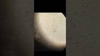 RBCs In urine Microscopy [upl. by Shuping]