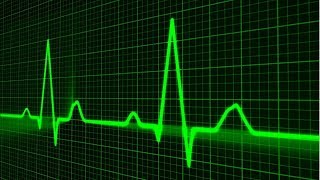 What is an abnormal EKG [upl. by Akemehc]