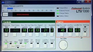 HOW TO CHANGE SETTINGS ON AN LTV VENTILATOR [upl. by Nnylyt]