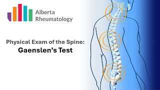 Rheumatology BACK exam Gaenslens Test [upl. by Oleta]