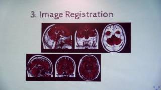 Data Analysis in MRI and PETMRI Neuroimaging  Davide Poggiali [upl. by Seligmann]