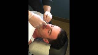 Nasal Specific Treatment  Procedure  Chiropractic Adjustment [upl. by Nilloc]