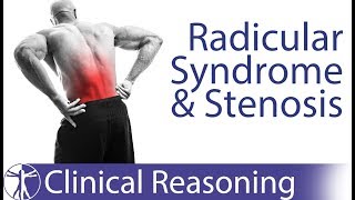 Lumbar Radicular Syndrome vs Intermittent Neurogenic ClaudicationStenosis [upl. by Reube794]