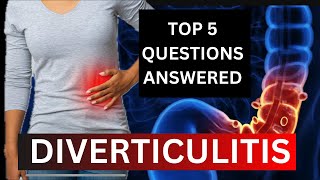 Unlocking the Secrets of Diverticulitis A Medical Students Guide [upl. by Halehs929]