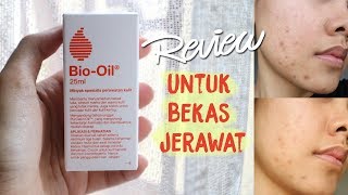 Mini Review BioOil ChitChat ENG SUBS [upl. by Sumedocin]