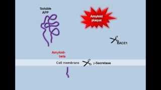 Plaque Formation in the Alzheimers Brain [upl. by Yorel]