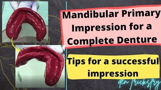 Mandibular Primary Impression for an Edentulous Patient Complete Denture Impression [upl. by Matta234]