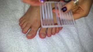 How to treat TOENAILS FUNGUS [upl. by Akehsat652]