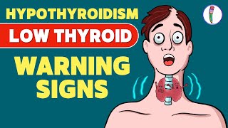 Signs that you have a Low Thyroid Level  Hypothyroidism  Signs amp Symptoms  Thyroid disease [upl. by Alyahs]