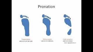 What Is Overpronation [upl. by Nonna]