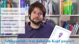 Schlaganfall – was dabei im Kopf passiert  NetDoktorde [upl. by Naillimxam501]