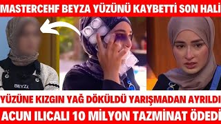 Masterchef Beyzanın Yüzüne Kızgın Yağ Döküldü Son Hali Acun Ilıcalı Tazminat BEYZA YARIŞMADAN ELENDİ [upl. by Arreip]