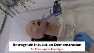 Retrograde Intubation Demonstration [upl. by Block44]