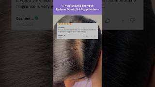 Get Rid of Dandruff using this dandruffshampoo ketoconazoleshampoo [upl. by Ruthi7]