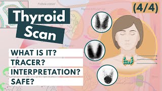 Thyroid Scan amp Radioactive Iodine  Nuclear medicine  Visual Explanation [upl. by Kcirtap293]