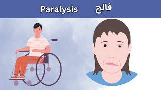 فالج  Paralysis [upl. by Inanuah]