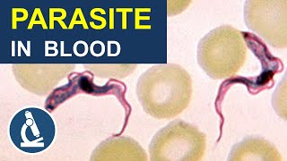 Blood Parasite That Makes You Sleepy Trypanosoma Under the Microscope [upl. by Nedyrb690]