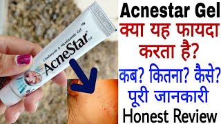 Acnestar Gel Review  Acnestar Gel Kaise Use Kare  Acnestar Gel Ke Fayde [upl. by Fatma]