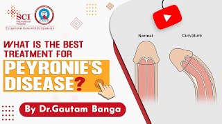 What is Peyronies Disease and Best Treatment For You  BY Dr Gautam Banga  SCI Hospital [upl. by Pascia670]