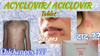 Acyclovir tablets  Herpikind  Herpikind Tablet  Zovirax  Zovirax tablets  uses side effects [upl. by Yldarb]