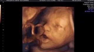 Amazing video shows 16 weeks babies SINGING in the womb Foetus can [upl. by Flo]