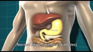 Diabetes and the body  Diabetes UK [upl. by Ainnek]