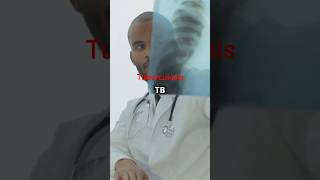 Understanding Tuberculosis Symptoms Diagnosis and Treatment tb disease shorts trending facts [upl. by Alexandrina]