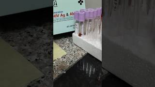 HIV Elisa test bloodtest youtubeshortstrending viralvideolabtech labtechnicianjob rrbvacancay [upl. by Mills591]