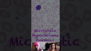 Pathophysiology of Microcytic Hypochromic Anemias [upl. by Dannica]