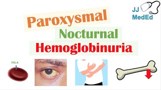 Paroxysmal Nocturnal Hemoglobinuria PNH  Causes amp Pathogenesis Symptoms Diagnosis amp Treatment [upl. by Nailimixam]