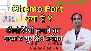 Chemo port कैनुला लगाये बिना कीमोथैरेपी कैसे देंHow to give chemotherapy without canula prick [upl. by Fredra]