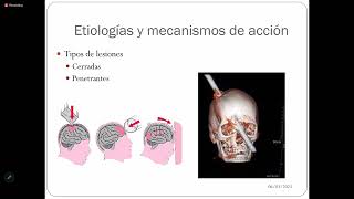 EMG Traumatismo Encefalocraneano  Dr Pedro Mejia 15 de mayo [upl. by Oloapnaig]