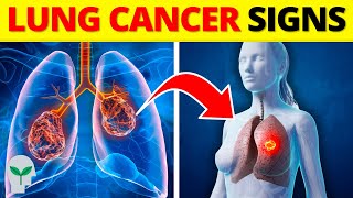 You MUST KNOW the Early Warning Signs of Lung Cancer [upl. by Aniras]