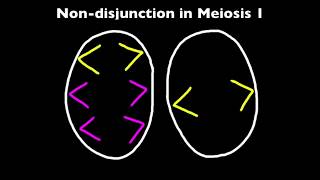 33 Nondisjunction and Down Syndrome [upl. by Aselehc727]