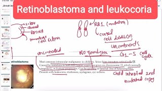 Retinoblastoma ophthalmology and leukocoria opthalmology 21  First Aid USMLE Step 1 in UrduHindi [upl. by Ennazor]