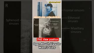 Para nasal sinus view PNS view  xray radiology shorts medical medicalimaging xrays xray [upl. by Mclaurin]