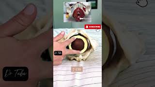 cervical dilation examination pregnancy baby delivery healthcare [upl. by Ilrahs]