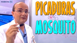 PICADURA DE MOSQUITO ¿Cómo es ¿Qué síntomas producen ¿Cómo hay que actuar ¿Cómo Prevenirlas [upl. by Nywg]