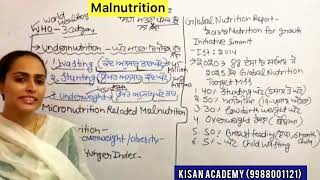 CDPO exam preparation CHILD welfare in India  MALNUTRITION PART A preparation [upl. by Assilen]